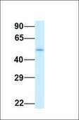 Anti-IKZF1 antibody produced in rabbit affinity isolated antibody