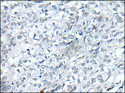 Anti-FLT4 affinity isolated antibody