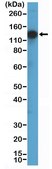 Anti-TRK (pan) Rabbit Monoclonal Antibody clone RM423, affinity purified immunoglobulin