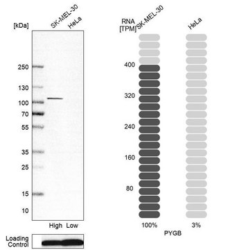 Anti-PYGB antibody produced in rabbit Prestige Antibodies&#174; Powered by Atlas Antibodies, affinity isolated antibody, buffered aqueous glycerol solution