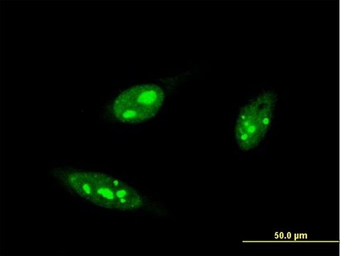 Monoclonal Anti-IRF4, (C-terminal) antibody produced in mouse clone 2D1, purified immunoglobulin, buffered aqueous solution