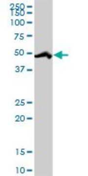 Anti-RBM39 antibody produced in rabbit purified immunoglobulin, buffered aqueous solution