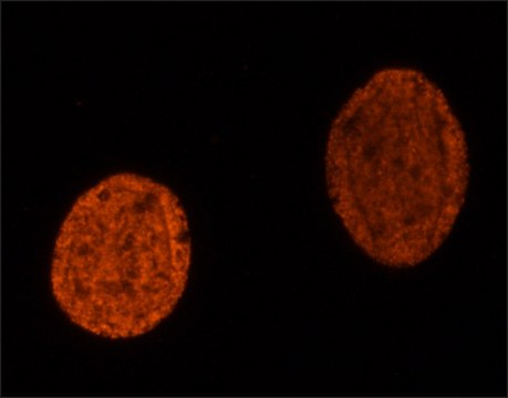 Anti-methyl-Histone H4 (Me-Lys20)antibody, Mouse monoclonal clone 5E10-D8, purified from hybridoma cell culture