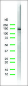 Anti-E-Cadherin antibody, Rabbit monoclonal clone SP64, recombinant, expressed in proprietary host, affinity isolated antibody