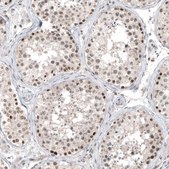 Monoclonal Anti-HDAC5 antibody produced in mouse Prestige Antibodies&#174; Powered by Atlas Antibodies, clone CL8121, purified immunoglobulin, buffered aqueous glycerol solution