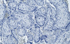Anti-Laminin-5 Antibody, clone 1D3 ZooMAb&#174; Rabbit Monoclonal recombinant, expressed in HEK 293 cells