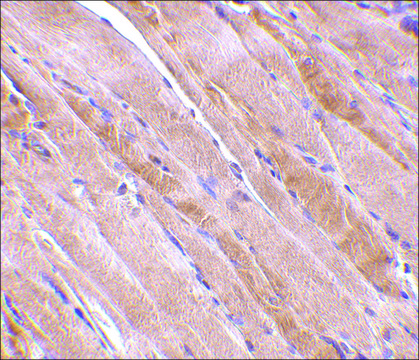 Anti-Emerin antibody produced in rabbit affinity isolated antibody, buffered aqueous solution