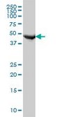 Monoclonal Anti-FH, (C-terminal) antibody produced in mouse clone 3E7, purified immunoglobulin, buffered aqueous solution