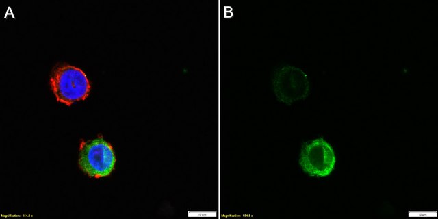 Anti-Migration Inhibitory Factor Related Proteins 8 and 14 Antibody, clone AHN-17 clone AHN-17, Chemicon&#174;, from mouse