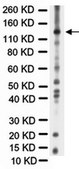 Anti-Nitric Oxide Synthase II Antibody serum, Chemicon&#174;