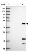 Anti-CEACAM16 antibody produced in rabbit Prestige Antibodies&#174; Powered by Atlas Antibodies, affinity isolated antibody, buffered aqueous glycerol solution