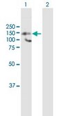 Anti-HDAC9 antibody produced in mouse purified immunoglobulin, buffered aqueous solution