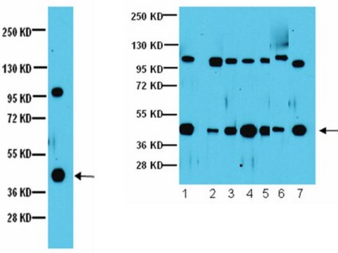 Anti-G&#946;5 Antibody Upstate&#174;, from rabbit