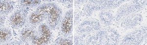 Anti-PPP3CC Antibody, clone 2C2 ZooMAb&#174; Rabbit Monoclonal recombinant, expressed in HEK 293 cells