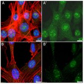 Anti-Myc Tag Antibody Upstate&#174;, from rabbit