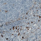 Monoclonal Anti-MMP9 antibody produced in mouse Prestige Antibodies&#174; Powered by Atlas Antibodies, clone CL0539, purified immunoglobulin, buffered aqueous glycerol solution