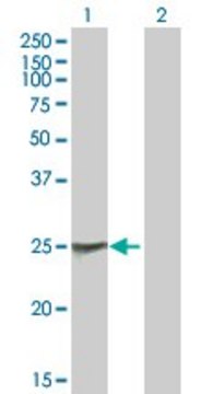 Anti-NAB2 antibody produced in mouse purified immunoglobulin, buffered aqueous solution