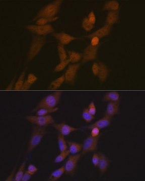Anti-STK33 antibody produced in rabbit