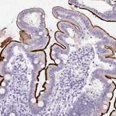 Anti-SI antibody produced in rabbit Prestige Antibodies&#174; Powered by Atlas Antibodies, affinity isolated antibody, buffered aqueous glycerol solution