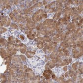 Anti-RNASE1 antibody produced in rabbit Prestige Antibodies&#174; Powered by Atlas Antibodies, affinity isolated antibody, buffered aqueous glycerol solution