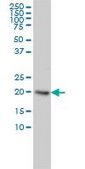 Monoclonal Anti-UBE2H antibody produced in mouse clone 3C4-1A2, purified immunoglobulin, buffered aqueous solution
