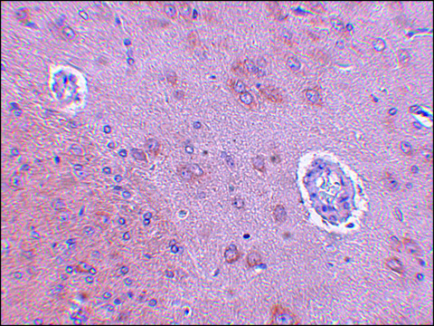 Anti-FAM120A antibody produced in rabbit affinity isolated antibody, buffered aqueous solution