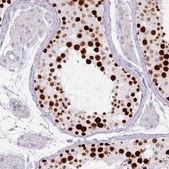 Monoclonal Anti-ATAD2 antibody produced in mouse Prestige Antibodies&#174; Powered by Atlas Antibodies, clone CL0182, purified immunoglobulin, buffered aqueous glycerol solution