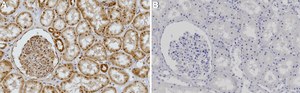 Anti-HIF-1α Antibody, clone 2B14 ZooMAb&#174; Rabbit Monoclonal recombinant, expressed in HEK 293 cells