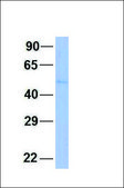Anti-IKZF1 antibody produced in rabbit affinity isolated antibody