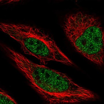 Anti-MACROD1 antibody produced in rabbit Prestige Antibodies&#174; Powered by Atlas Antibodies, affinity isolated antibody