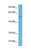 Anti-EYA1 antibody produced in rabbit affinity isolated antibody