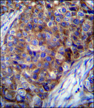 ANTI-COX7A2L (CENTER) antibody produced in rabbit IgG fraction of antiserum, buffered aqueous solution