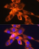 Anti-RPS19 antibody produced in rabbit