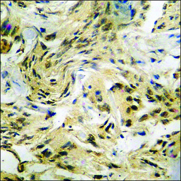 Anti-phospho-AFX (pSer197) antibody produced in rabbit affinity isolated antibody