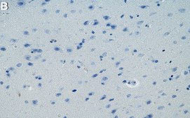 Anti-Tau Antibody, clone T49 ZooMAb&#174; Mouse Monoclonal recombinant, expressed in HEK 293 cells