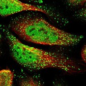 Anti-RAD1 antibody produced in rabbit Prestige Antibodies&#174; Powered by Atlas Antibodies, affinity isolated antibody, buffered aqueous glycerol solution