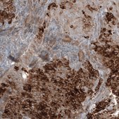 Anti-WFDC2 antibody produced in mouse Prestige Antibodies&#174; Powered by Atlas Antibodies, clone CL12886, purified by using Protein A, buffered aqueous glycerol solution