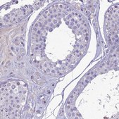 Anti-NOVA2 antibody produced in rabbit Prestige Antibodies&#174; Powered by Atlas Antibodies, affinity isolated antibody, buffered aqueous glycerol solution