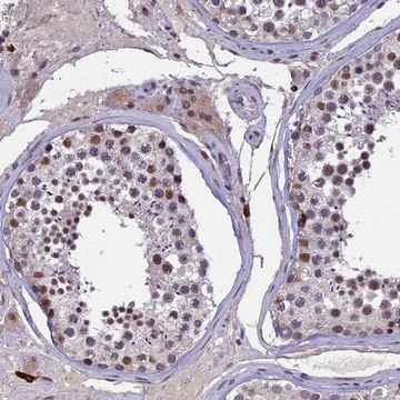 Anti-RNF40 antibody produced in rabbit Prestige Antibodies&#174; Powered by Atlas Antibodies, affinity isolated antibody, buffered aqueous glycerol solution