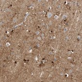 Anti-GLUL antibody produced in rabbit Ab2, Prestige Antibodies&#174; Powered by Atlas Antibodies, affinity isolated antibody, buffered aqueous glycerol solution