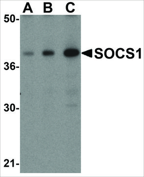 Anti-SOCS1 (ab1) antibody produced in rabbit affinity isolated antibody, buffered aqueous solution