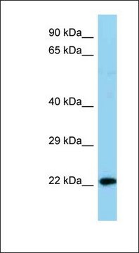 Anti-NDUFB8 antibody produced in rabbit affinity isolated antibody