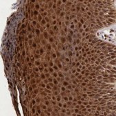 Anti-CSTA antibody produced in rabbit Prestige Antibodies&#174; Powered by Atlas Antibodies, affinity isolated antibody, buffered aqueous glycerol solution