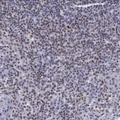 Anti-VRK1 antibody produced in rabbit Prestige Antibodies&#174; Powered by Atlas Antibodies, affinity isolated antibody, buffered aqueous glycerol solution