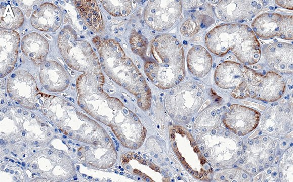Anti-NDRG1 Antibody, clone 1C11 ZooMAb&#174; Rabbit Monoclonal recombinant, expressed in HEK 293 cells