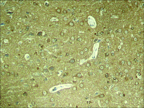 Anti-phospho-MAPT (pSer404) antibody produced in rabbit affinity isolated antibody