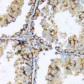 Anti-Cortactin antibody produced in rabbit