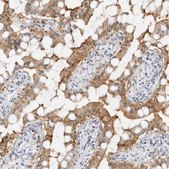Anti-SLC9A3R1 antibody produced in rabbit Prestige Antibodies&#174; Powered by Atlas Antibodies, affinity isolated antibody, buffered aqueous glycerol solution