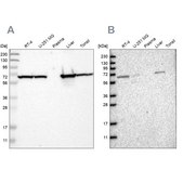 Anti-ACADVL antibody produced in rabbit Prestige Antibodies&#174; Powered by Atlas Antibodies, affinity isolated antibody, buffered aqueous glycerol solution, Ab1