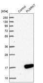 Anti-PLGRKT antibody produced in rabbit Ab1, Prestige Antibodies&#174; Powered by Atlas Antibodies, affinity isolated antibody, buffered aqueous glycerol solution